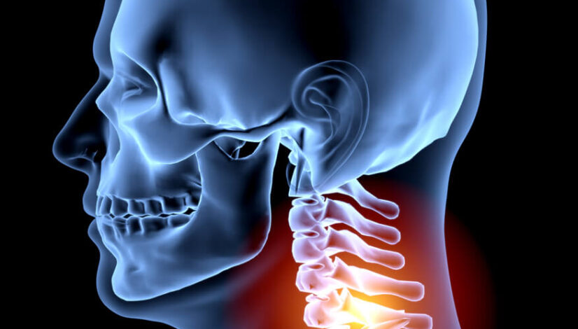 human-spine-human-neck-pain-x-ray